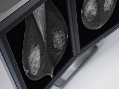Mammography Analysis 