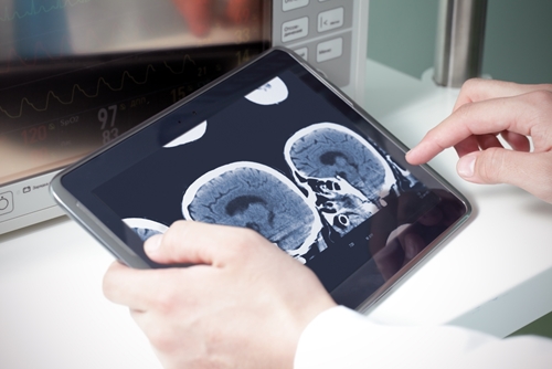 In January, HIMSS released its 2015 Imaging Technology Study.
